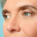 get rid of crow's feet